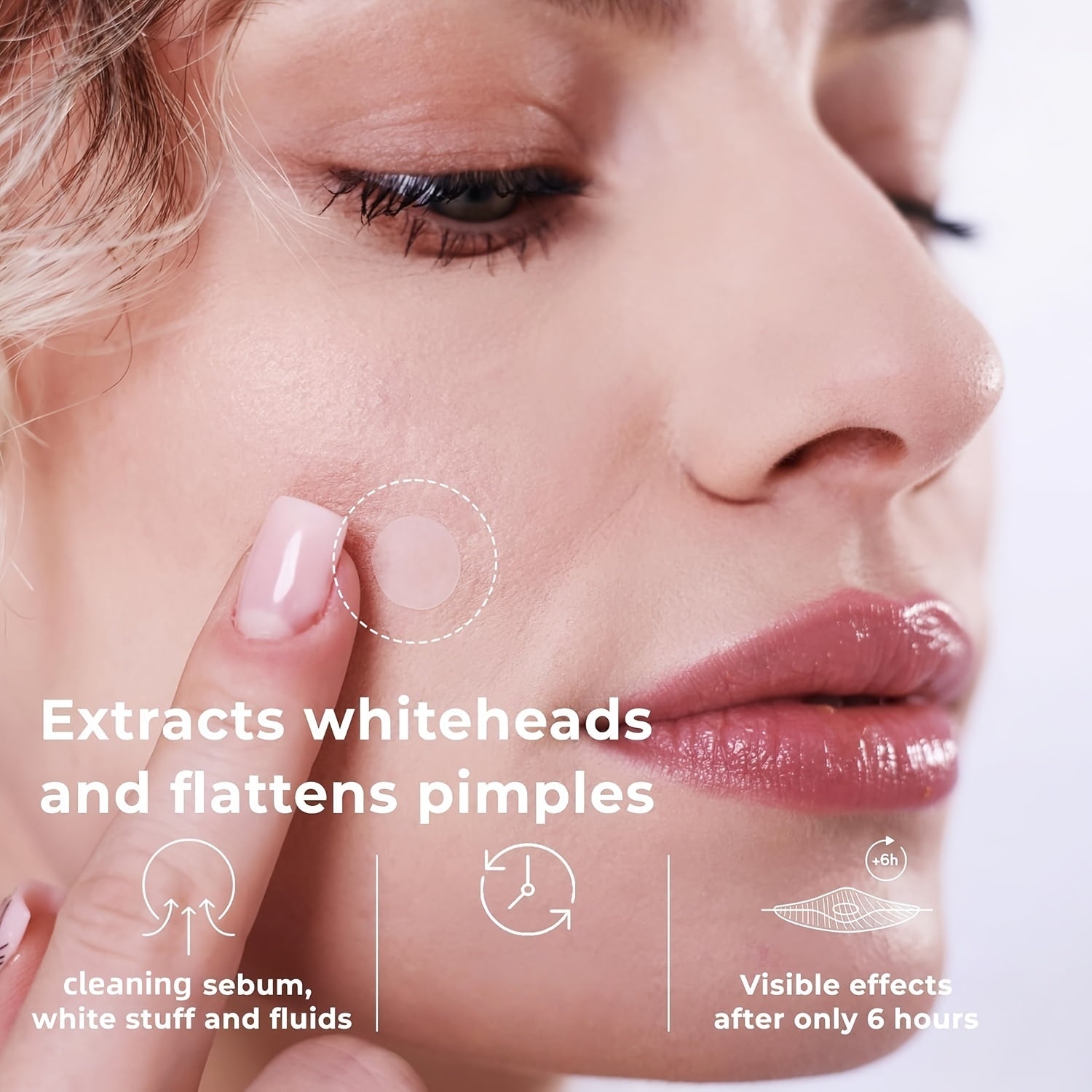 HITWORKER Hydrocolloid pimple patches